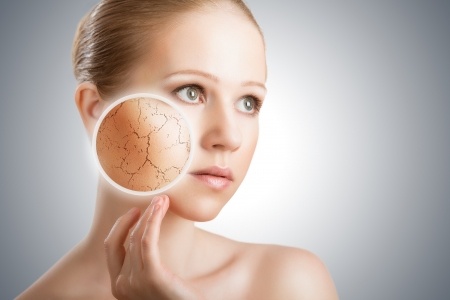  Hard Water Dry Skin